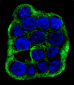 CLCN7 Antibody (C-term)